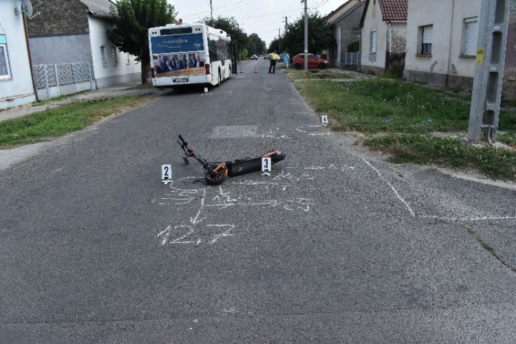 Tegnap súlyosan megsérült egy e-rolleren utazó 15 éves fiú Tolna vármegyében
